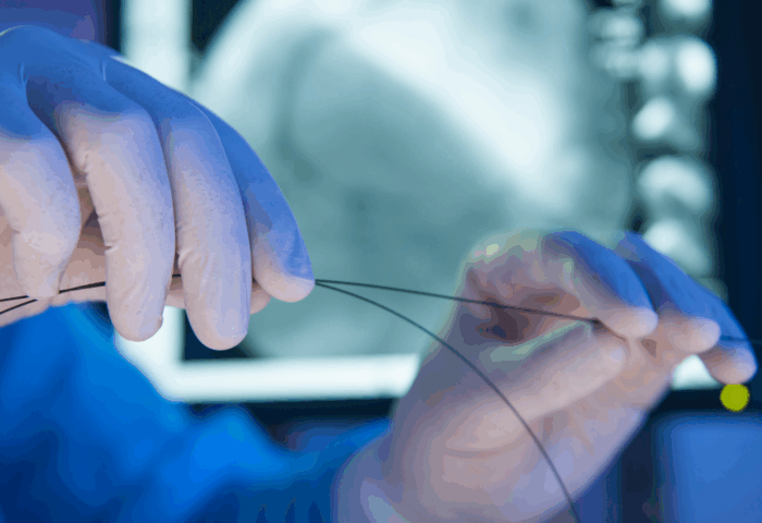 Medical Wire
